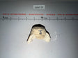 1/6 Scale WWII German Winter Fur Ushanka Hat